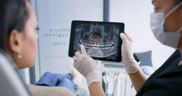 Licensed Tooth Extraction service in Sausalito, CA - Smile Center Dentistry